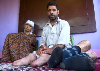 India using torture as tool to stifle Kashmiris’ political voice for plebiscite