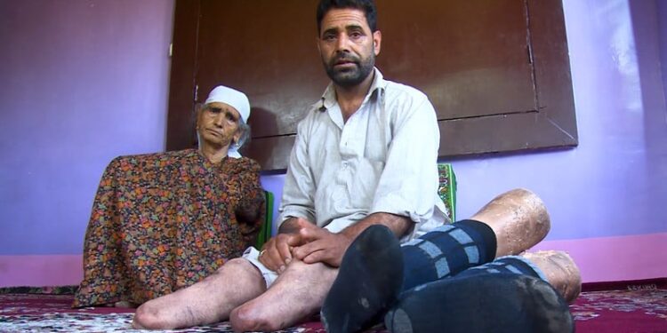 India using torture as tool to stifle Kashmiris’ political voice for plebiscite